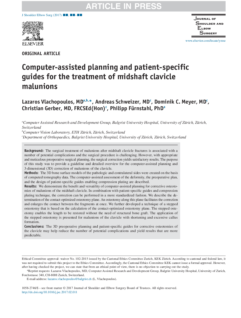 Computer-assisted planning and patient-specific guides for the treatment of midshaft clavicle malunions
