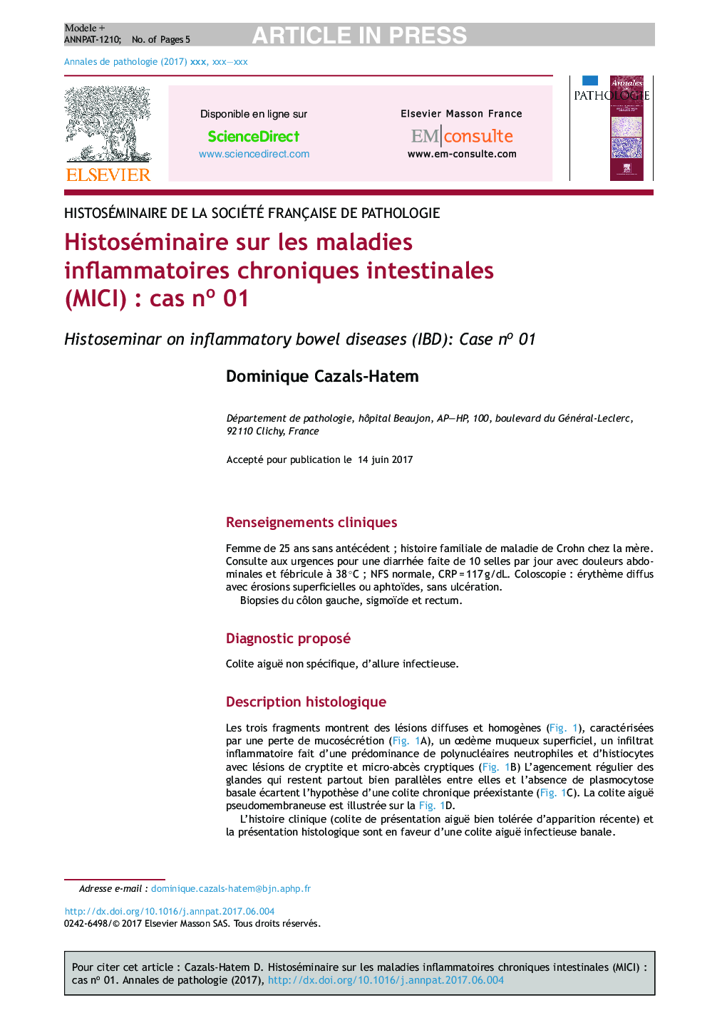 Histoséminaire sur les maladies inflammatoires chroniques intestinales (MICI)Â : cas noÂ 01