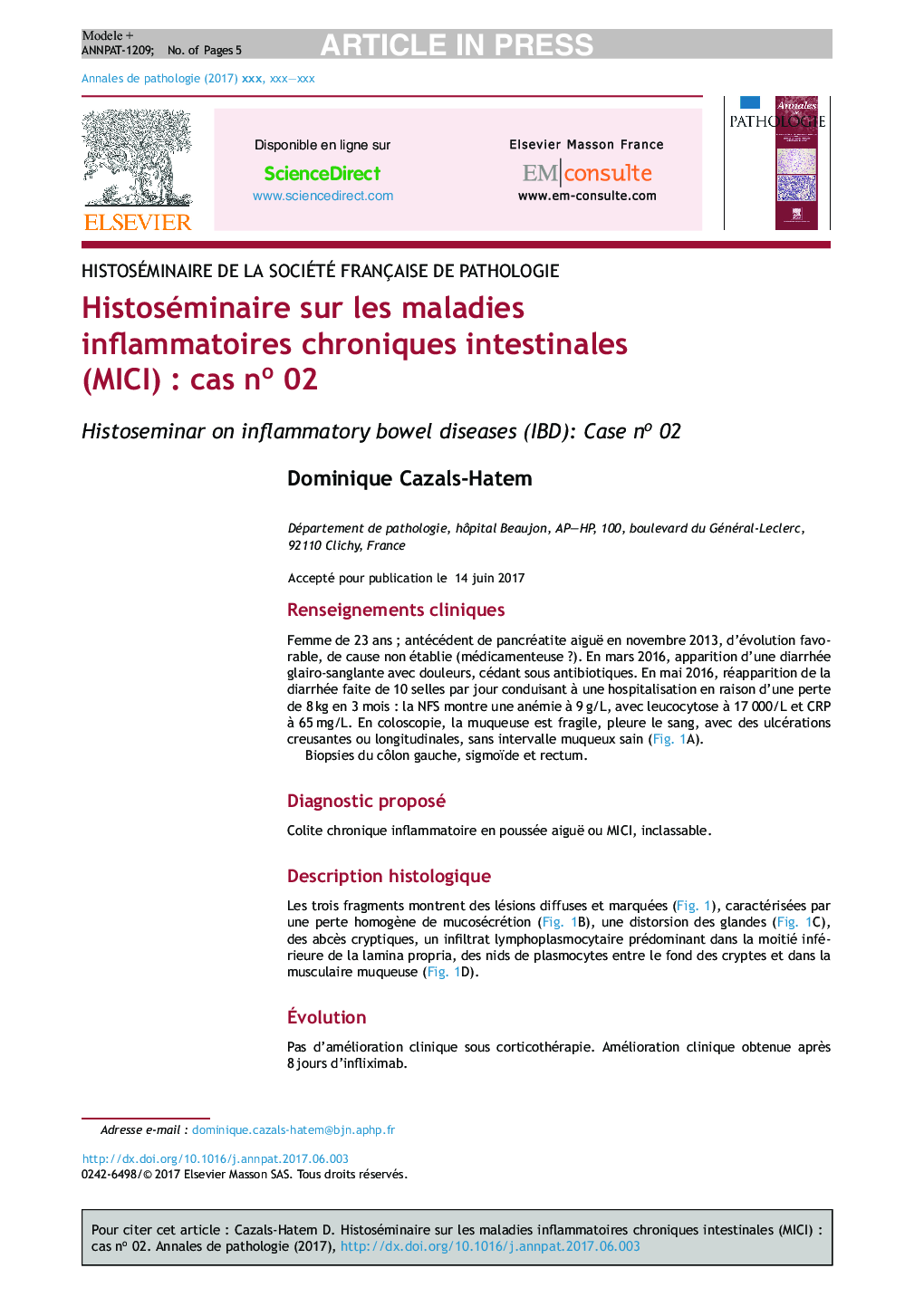 Histoséminaire sur les maladies inflammatoires chroniques intestinales (MICI)Â : cas noÂ 02