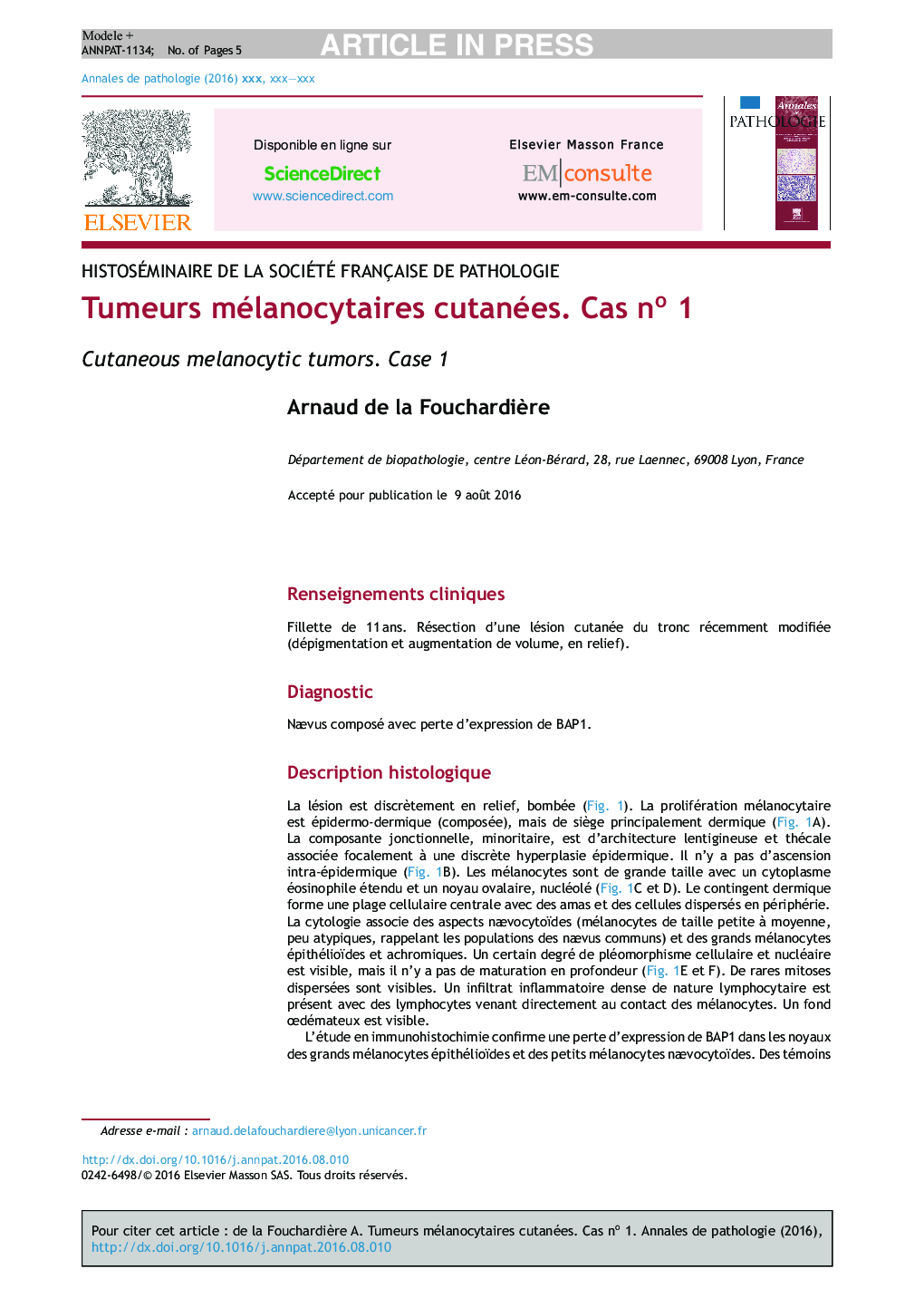 Tumeurs mélanocytaires cutanées. Cas noÂ 1