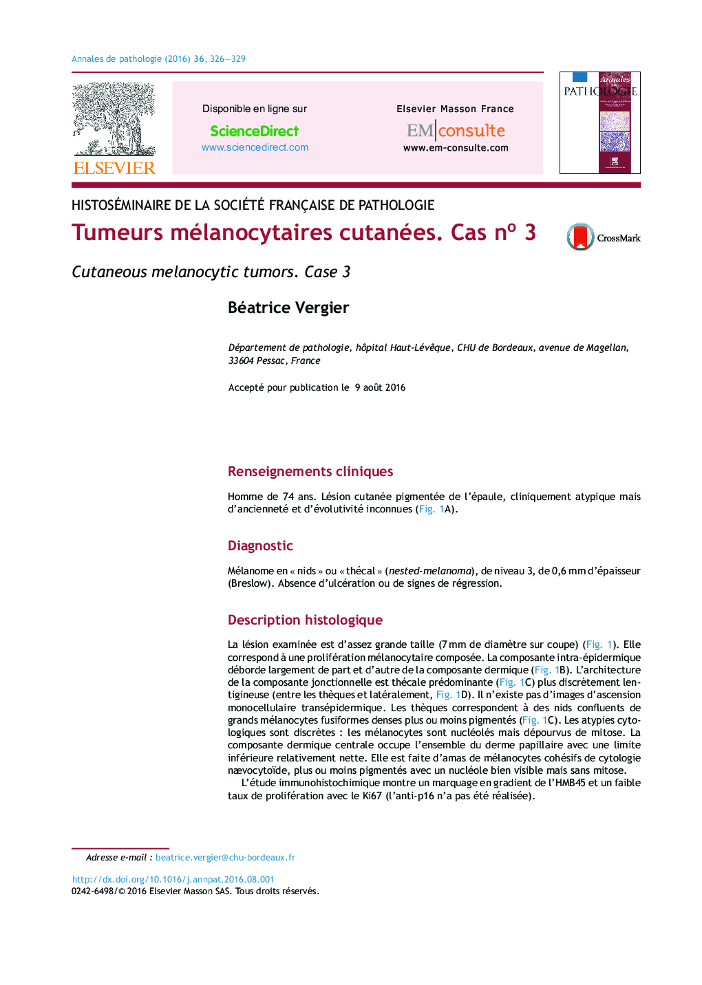 Tumeurs mélanocytaires cutanées. Cas noÂ 3