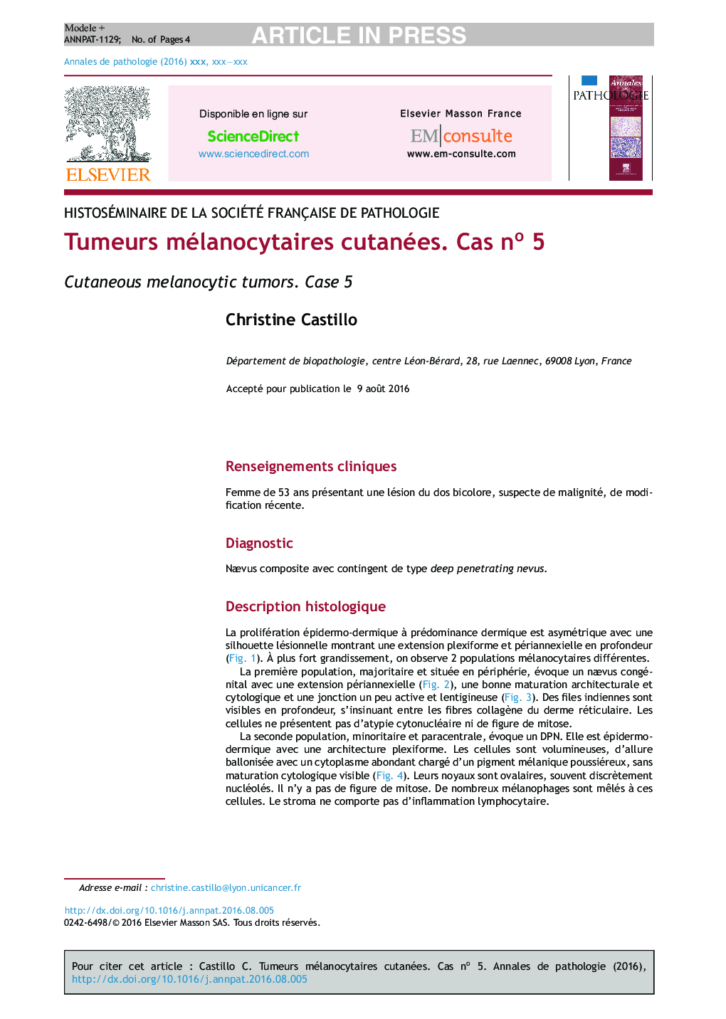 Tumeurs mélanocytaires cutanées. Cas noÂ 5