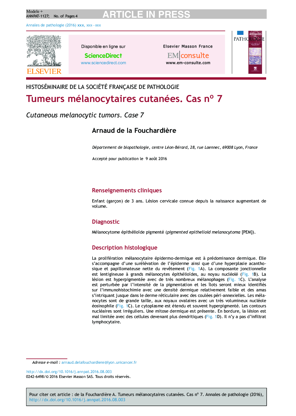 Tumeurs mélanocytaires cutanées. Cas noÂ 7