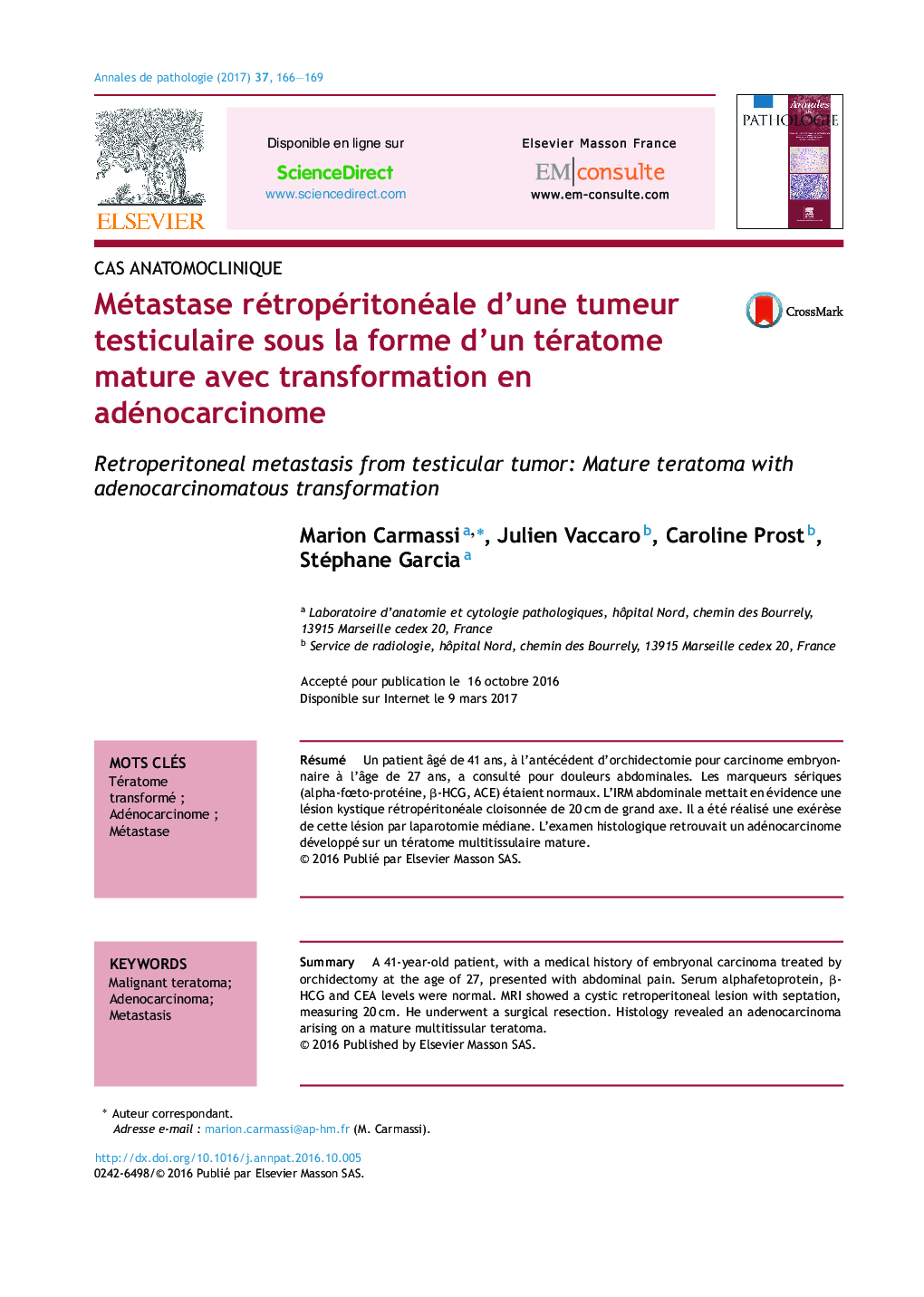 Métastase rétropéritonéale d'une tumeur testiculaire sous la forme d'un tératome mature avec transformation en adénocarcinome