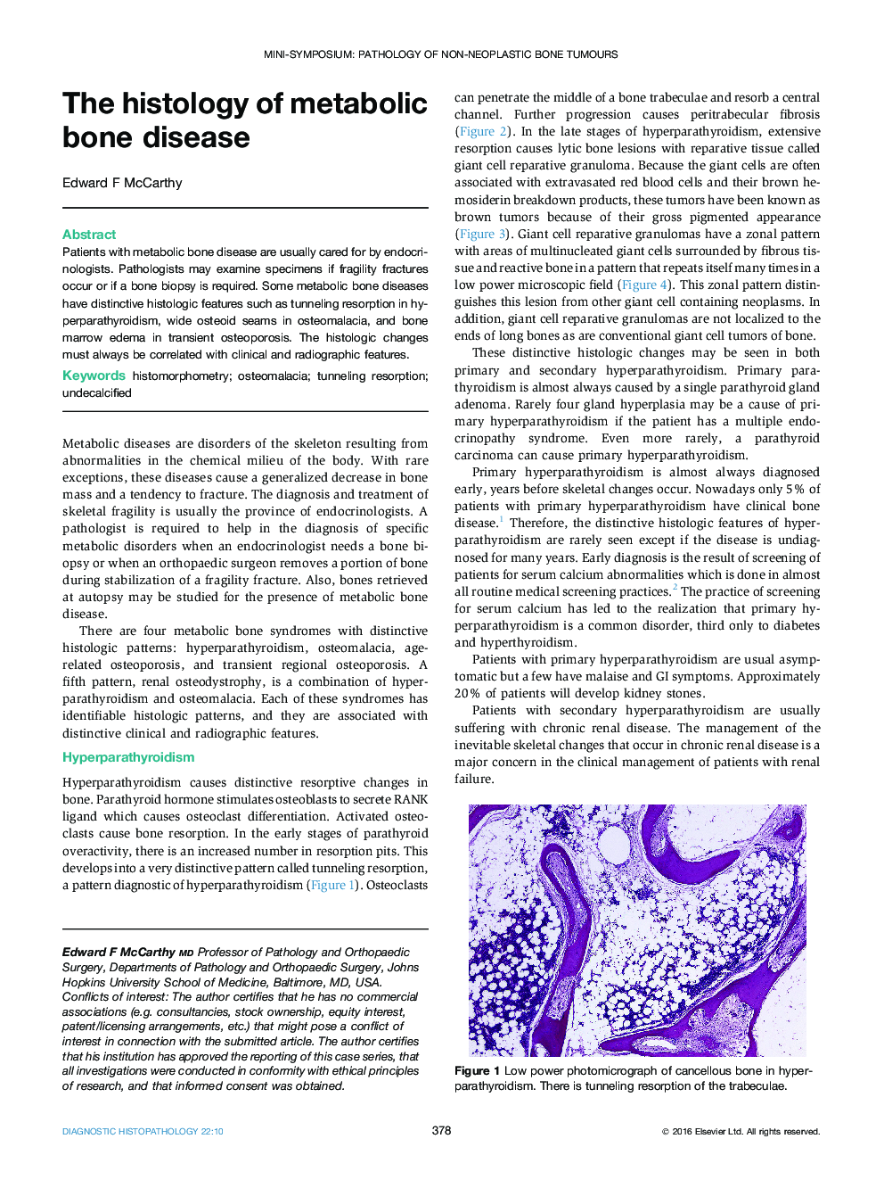 Mini-symposium: pathology of non-neoplastic bone tumoursThe histology of metabolic bone disease