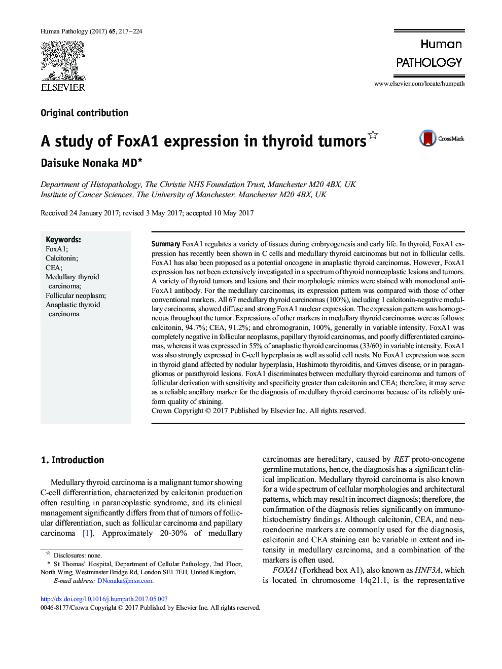 Original contributionA study of FoxA1 expression in thyroid tumors