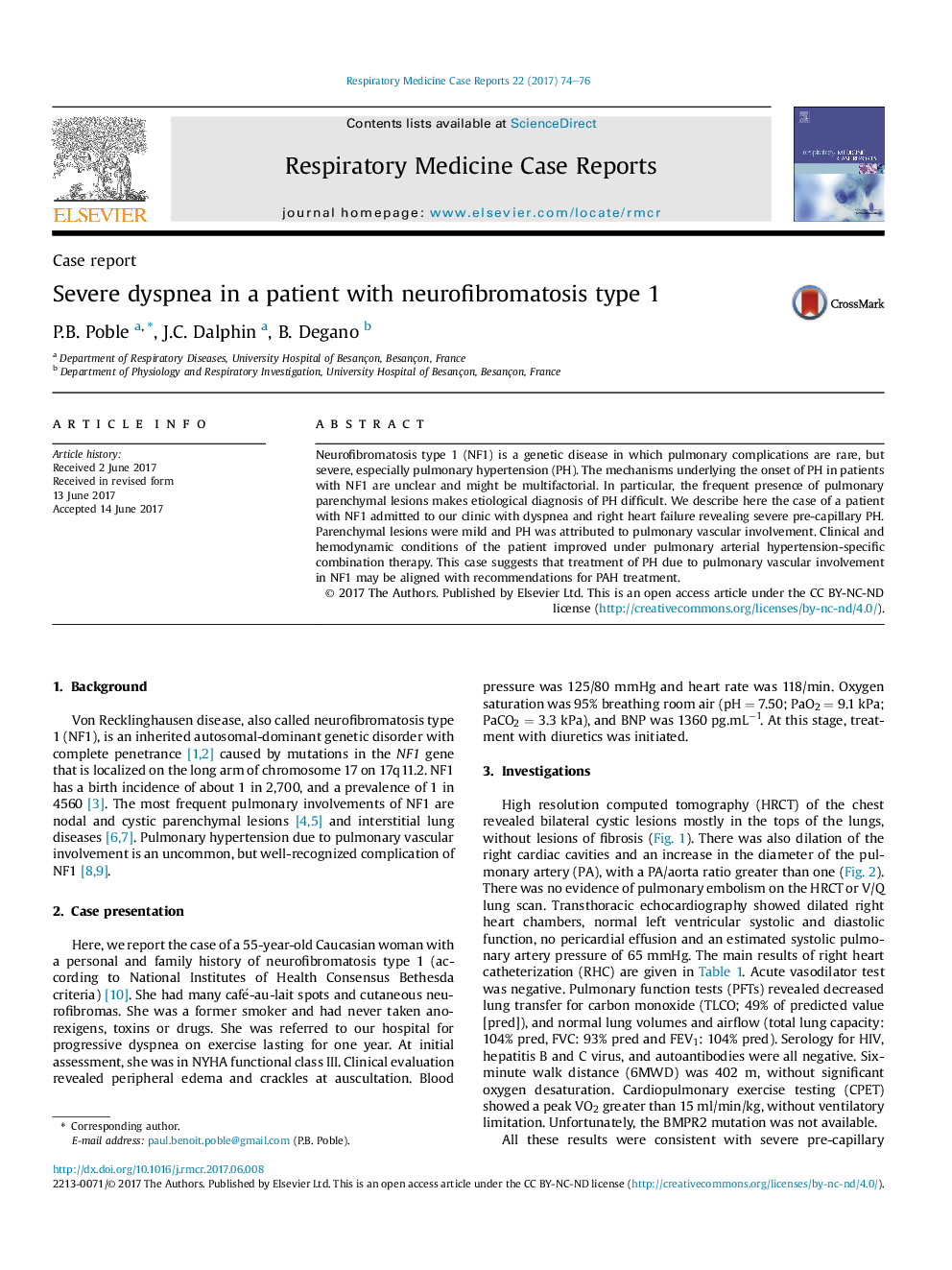 Case reportSevere dyspnea in a patient with neurofibromatosis type 1