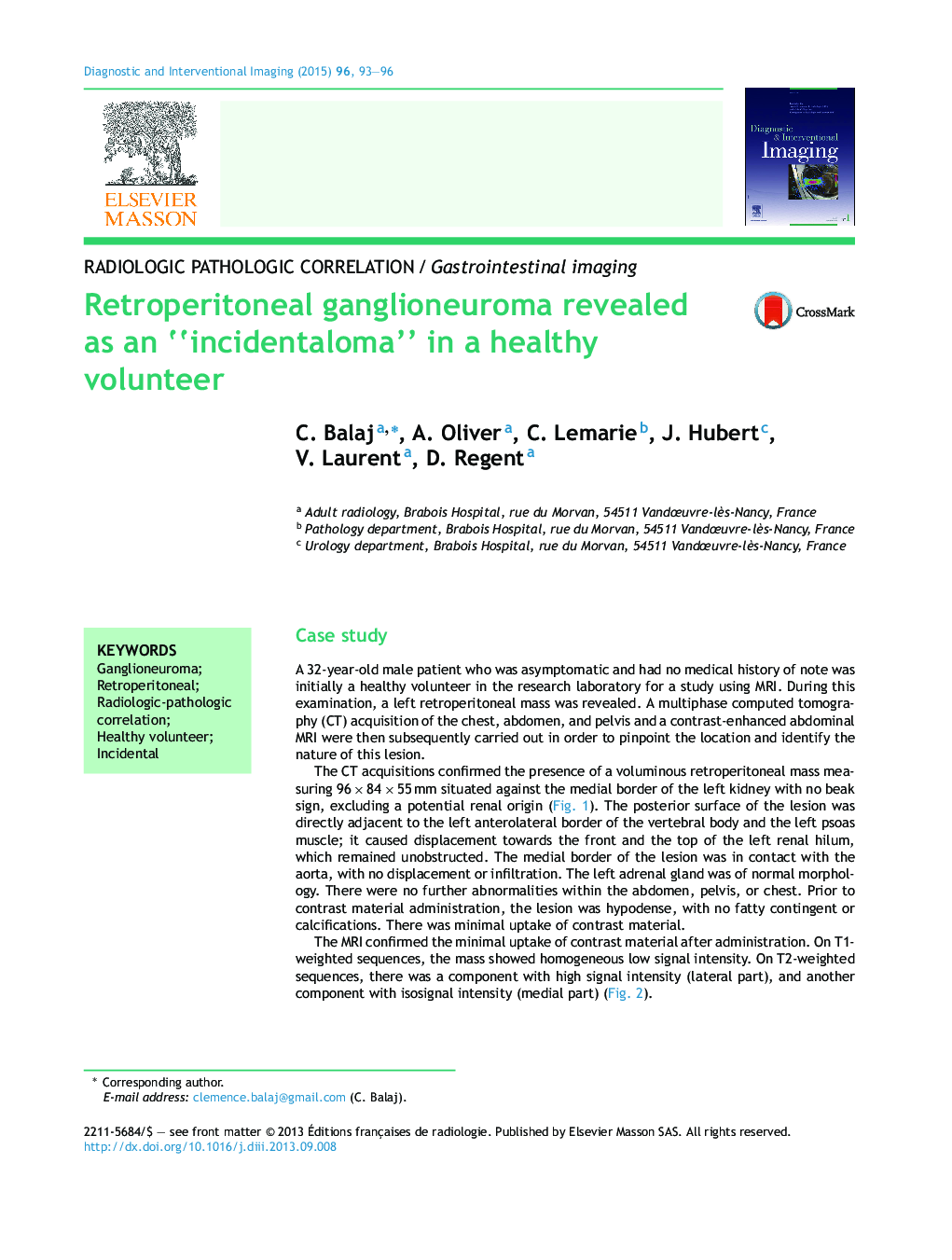 Retroperitoneal ganglioneuroma revealed as an “incidentaloma” in a healthy volunteer