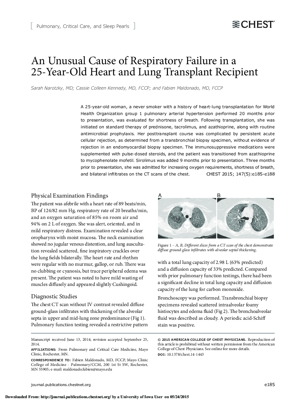 An Unusual Cause of Respiratory Failure in a 25-Year-Old Heart and Lung Transplant Recipient