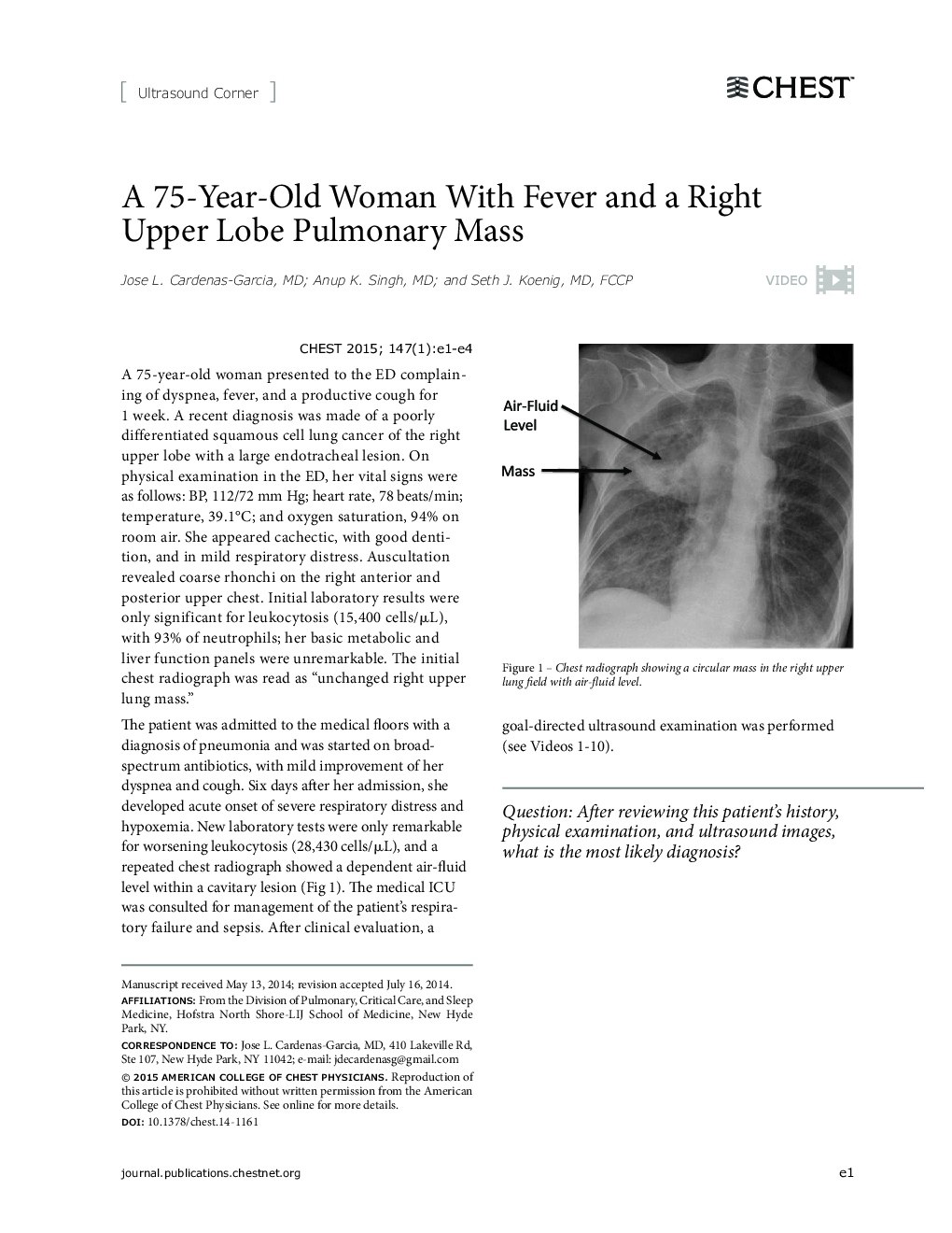A 75-Year-Old Woman With Fever and a Right Upper Lobe Pulmonary Mass