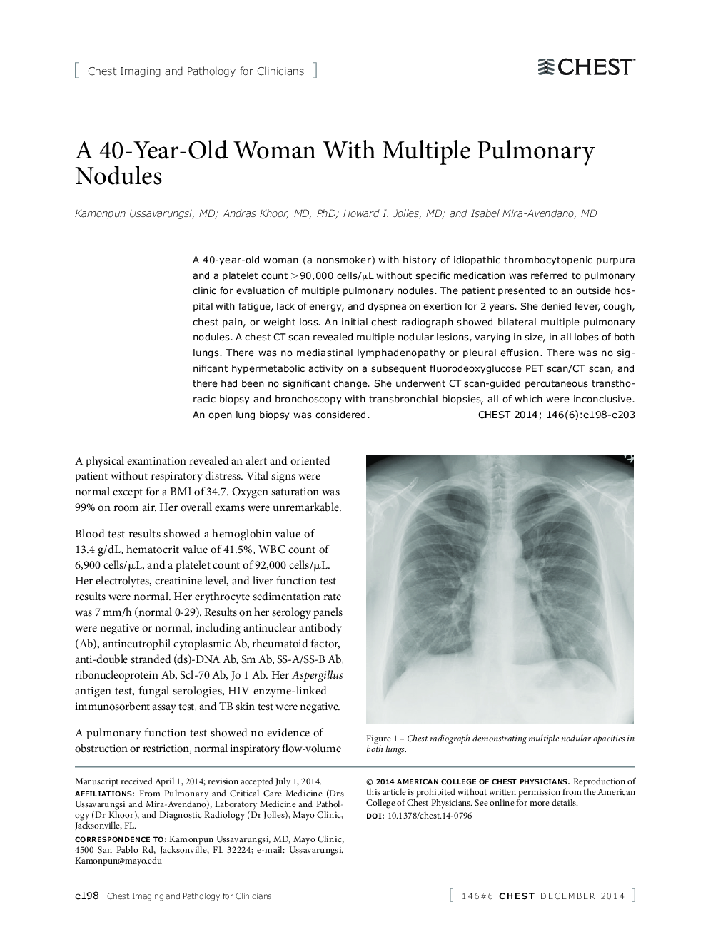 تصویربرداری قفسه سینه و آسیب شناسی برای کلینیک ها خانم 40 ساله مبتلا به مولکول های متعدد ریوی 