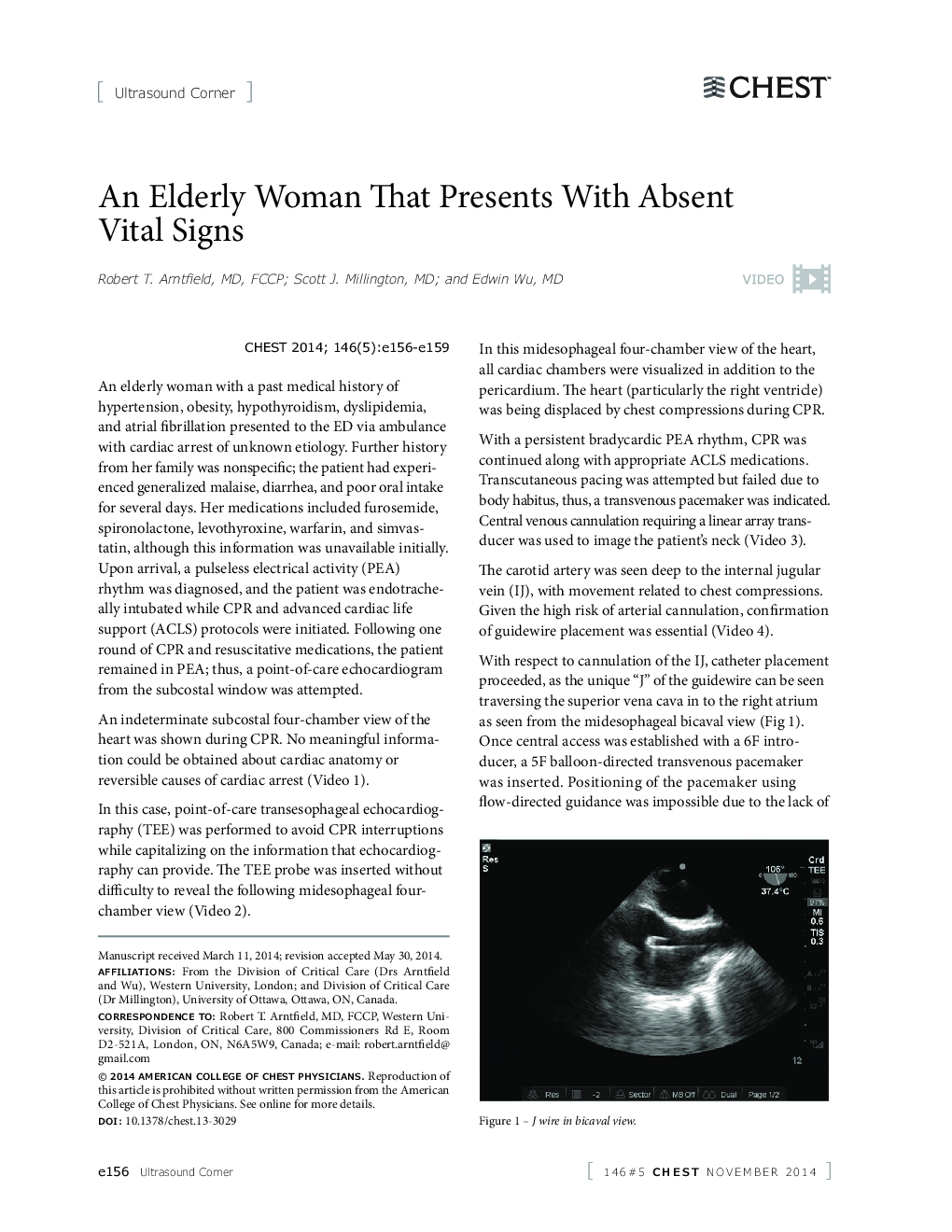 An Elderly Woman That Presents With Absent Vital Signs