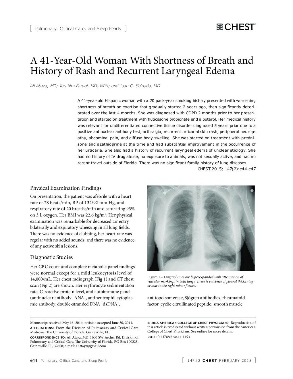 A 41-Year-Old Woman With Shortness of Breath and History of Rash and Recurrent Laryngeal Edema