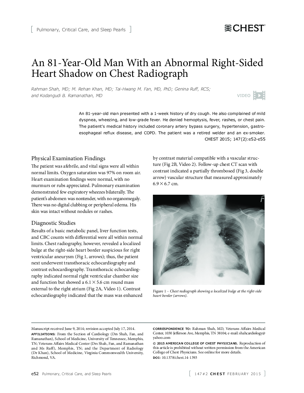 An 81-Year-Old Man With an Abnormal Right-Sided Heart Shadow on Chest Radiograph