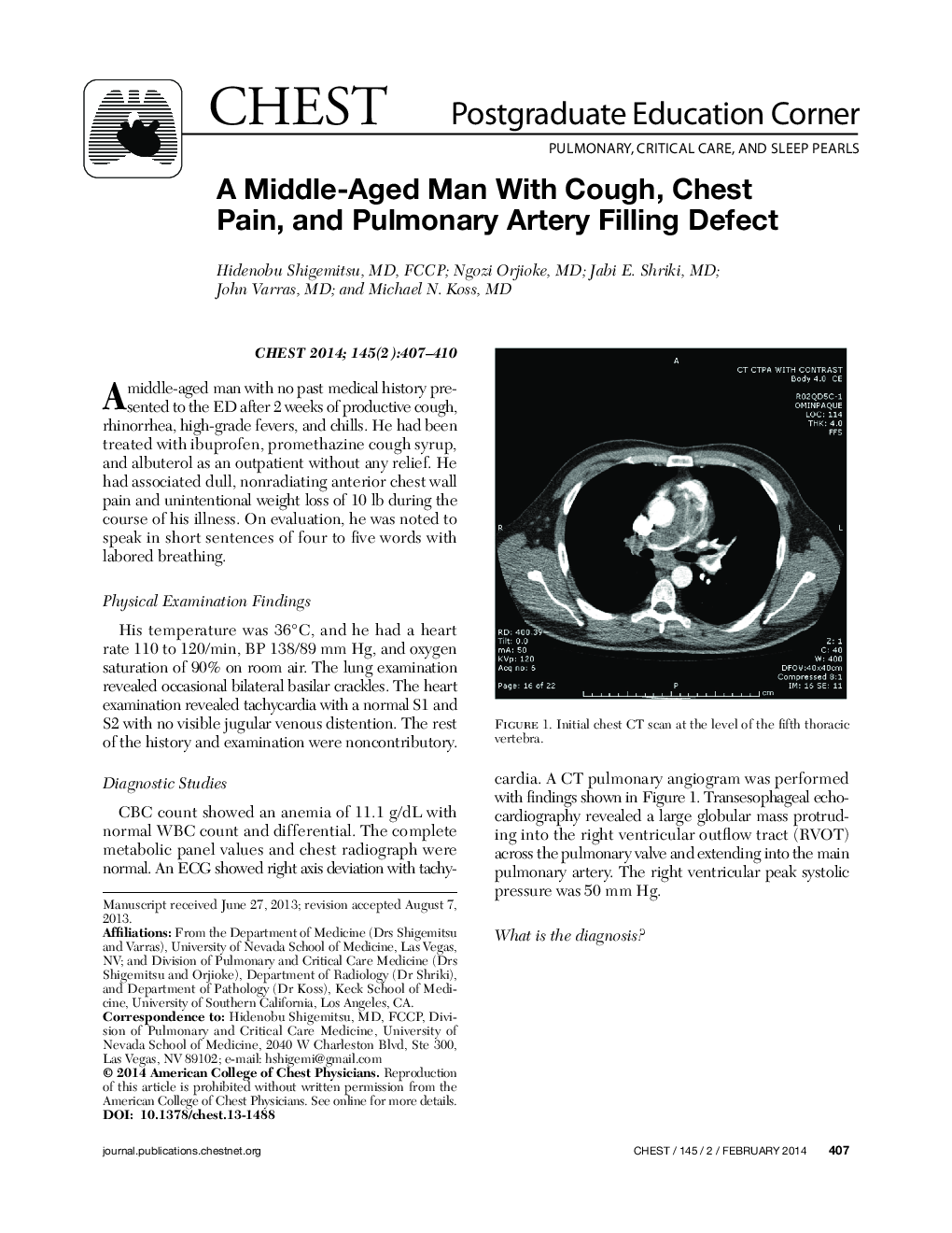 A Middle-Aged Man With Cough, Chest Pain, and Pulmonary Artery Filling Defect