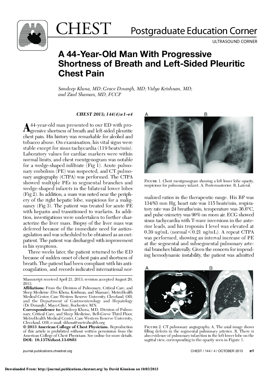 Normalization of Sweat Chloride Concentration and Clinical Improvement With Ivacaftor in a Patient With Cystic Fibrosis With Mutation S549N