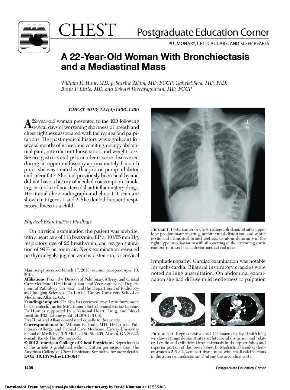 عکس صفحه اول مقاله: A 22-Year-Old Woman With Bronchiectasis and a Mediastinal Mass A 22-Year-Old Woman With Bronchiectasis and a Mediastinal Mass