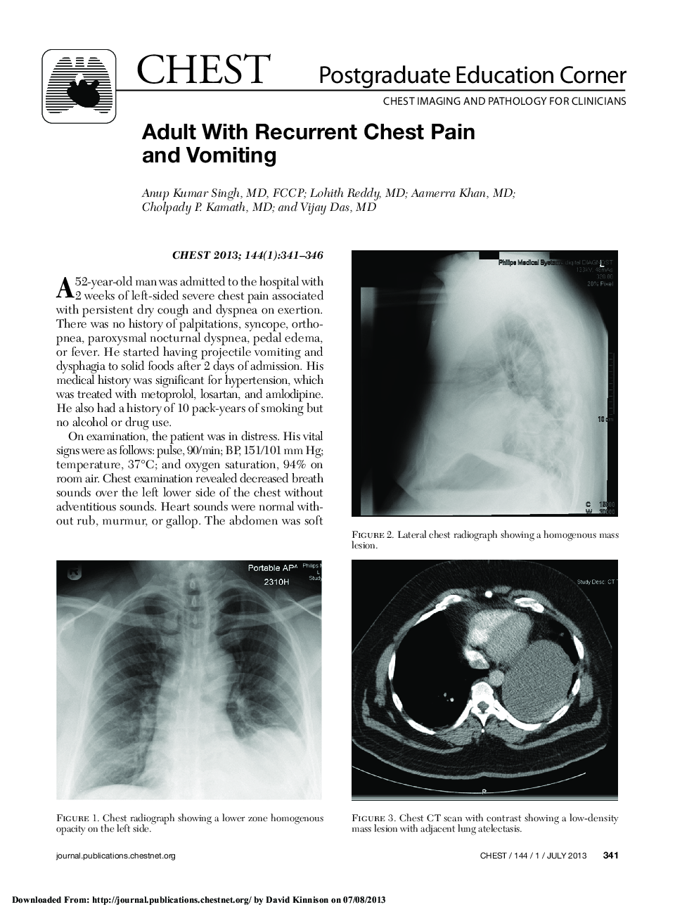 Adult With Recurrent Chest Pain and Vomiting