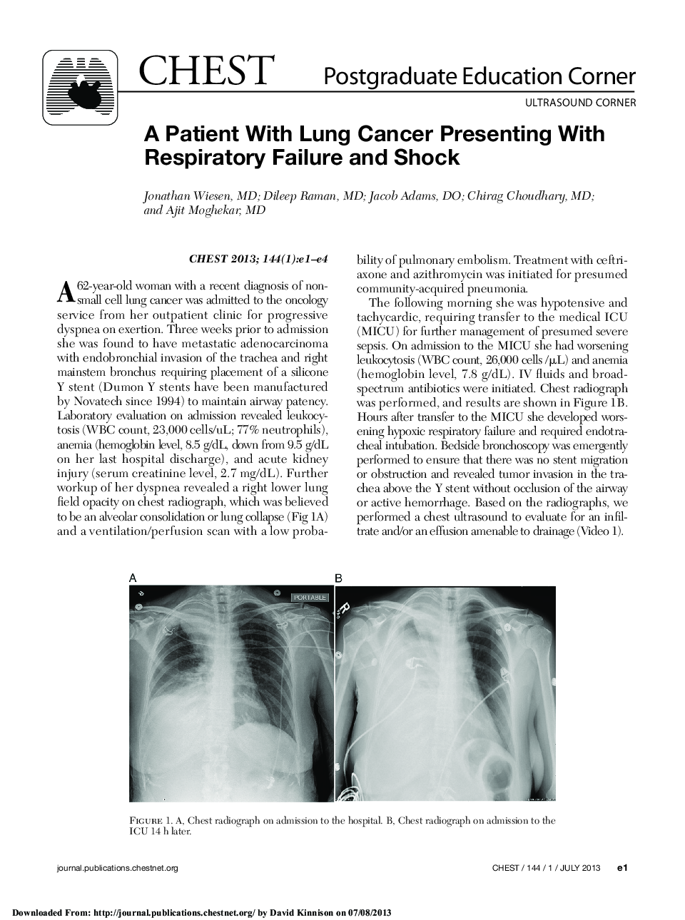 A Patient With Lung Cancer Presenting With Respiratory Failure and Shock