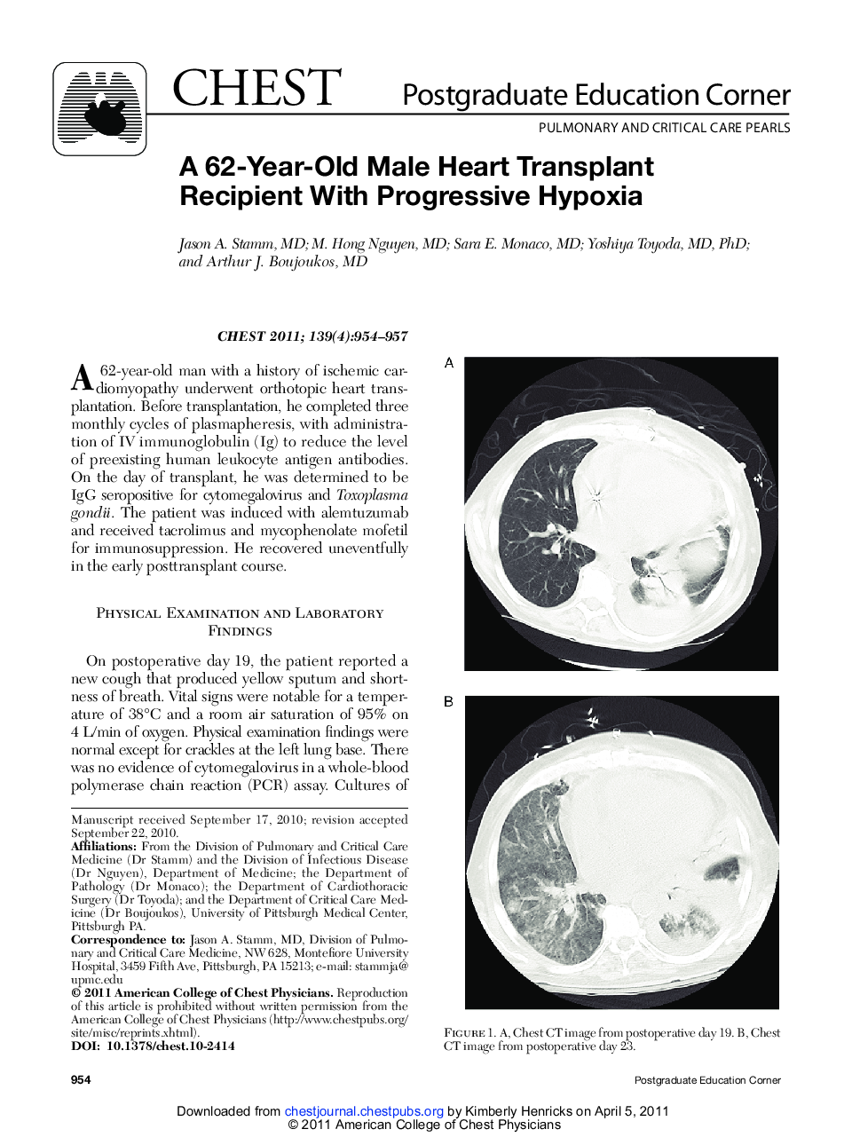 A 62-Year-Old Male Heart Transplant Recipient With Progressive Hypoxia