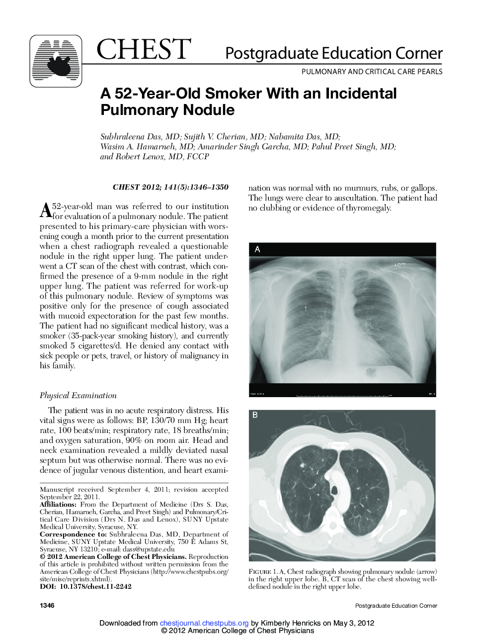 A 52-Year-Old Smoker With an Incidental Pulmonary Nodule