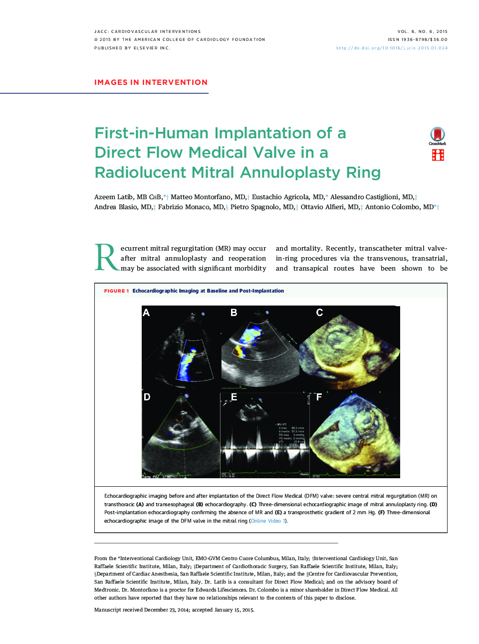 First-in-Human Implantation of a Direct Flow Medical Valve in a Radiolucent Mitral Annuloplasty Ring