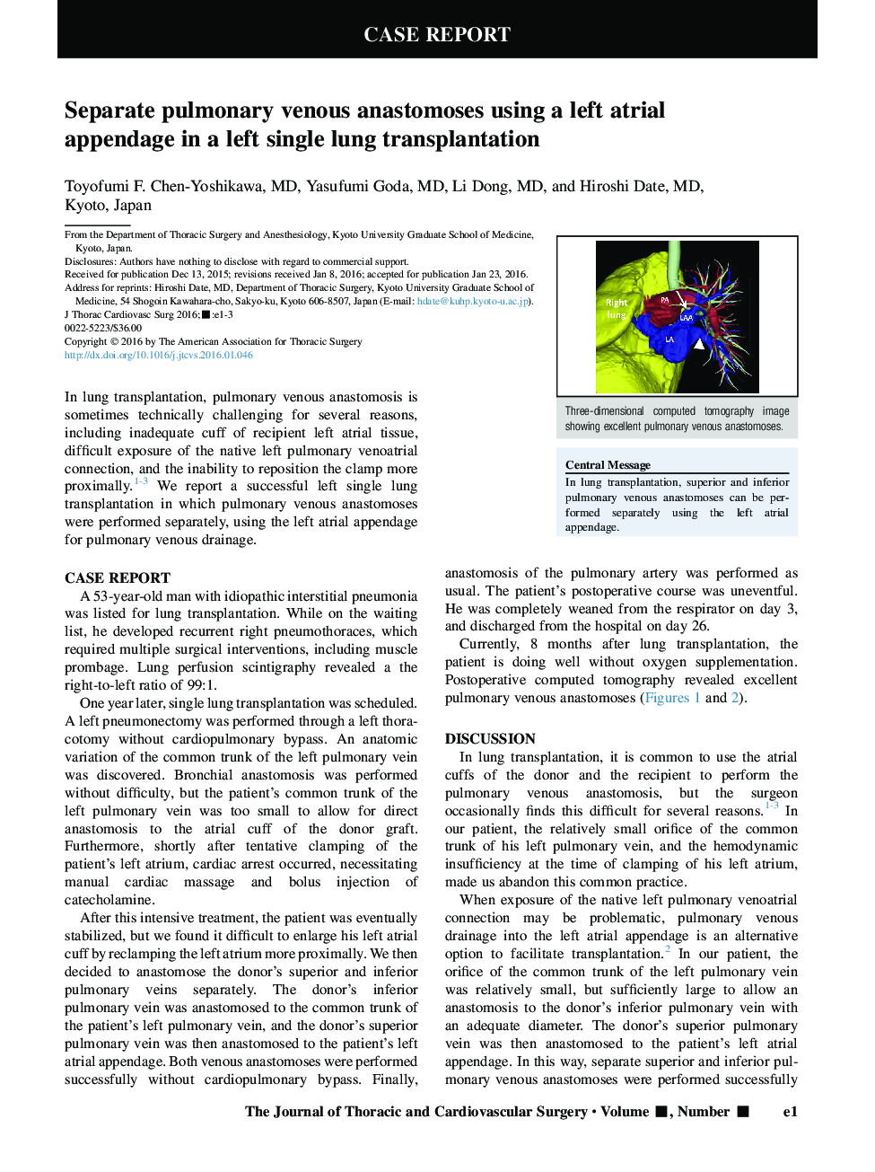 Separate pulmonary venous anastomoses using a left atrial appendage in a left single lung transplantation