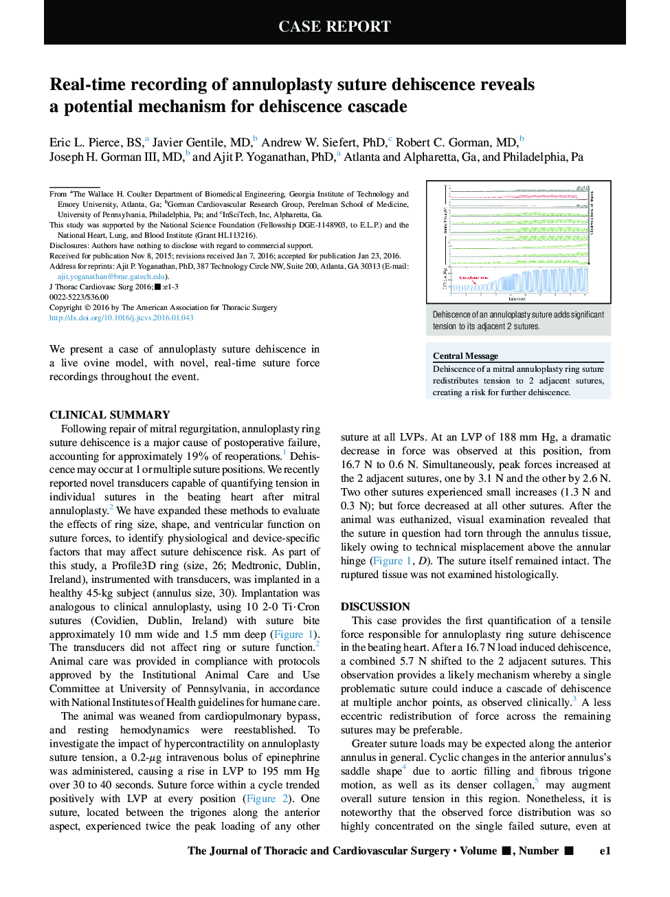 Real-time recording of annuloplasty suture dehiscence reveals a potential mechanism for dehiscence cascade