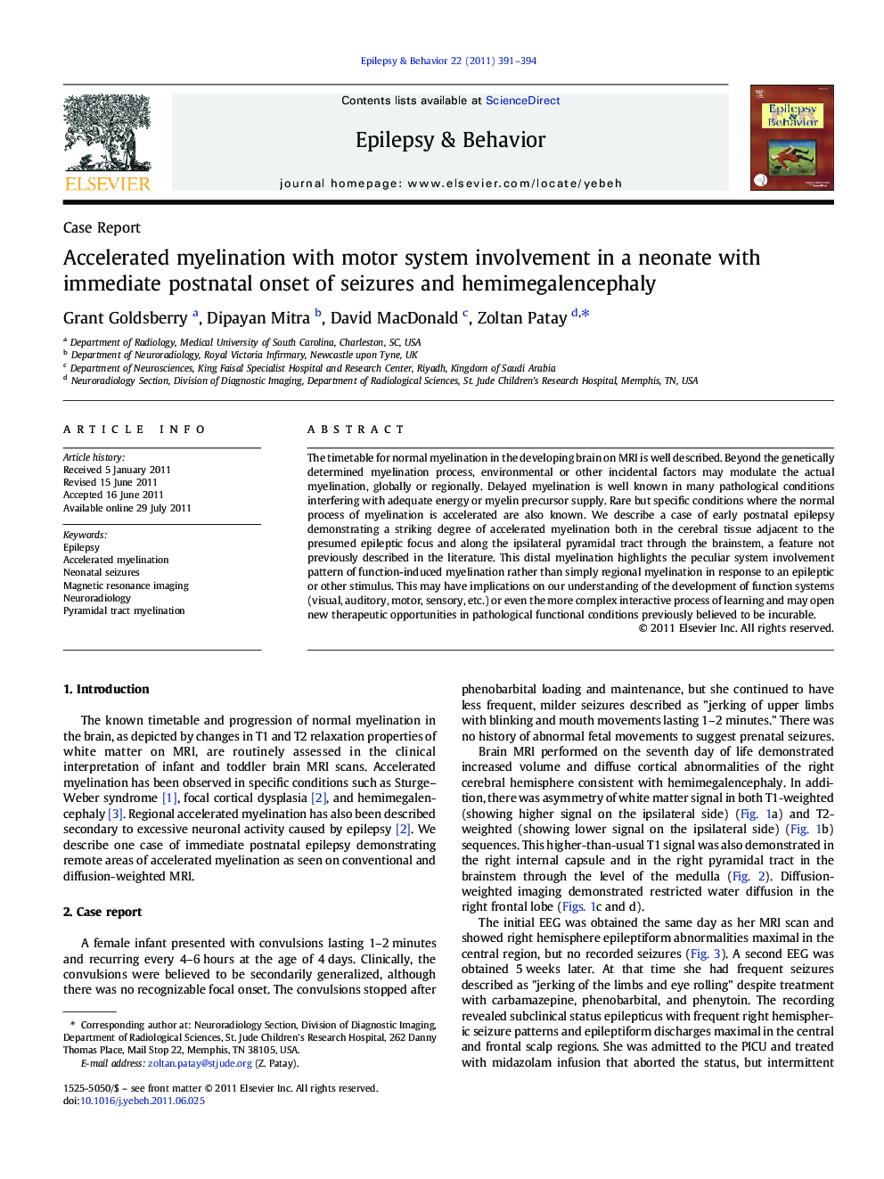 Accelerated myelination with motor system involvement in a neonate with immediate postnatal onset of seizures and hemimegalencephaly