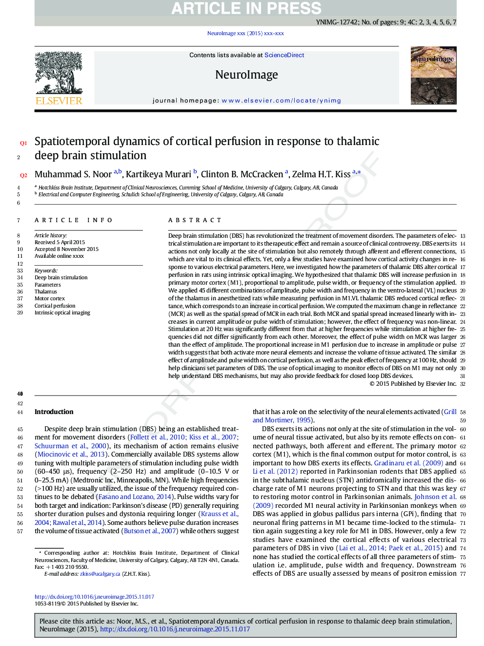 Spatiotemporal dynamics of cortical perfusion in response to thalamic deep brain stimulation