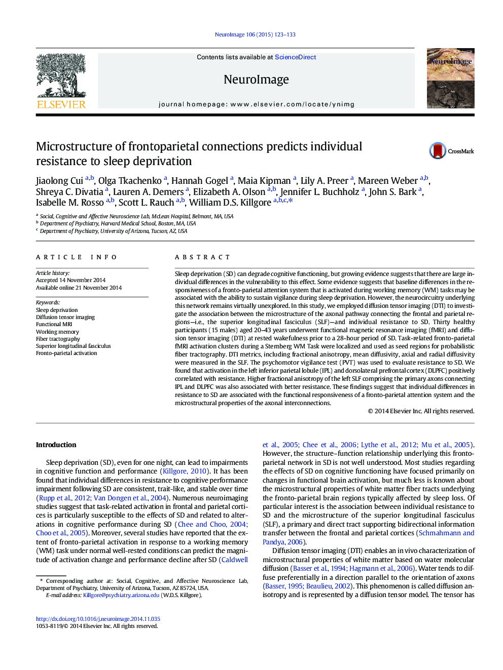 Microstructure of frontoparietal connections predicts individual resistance to sleep deprivation