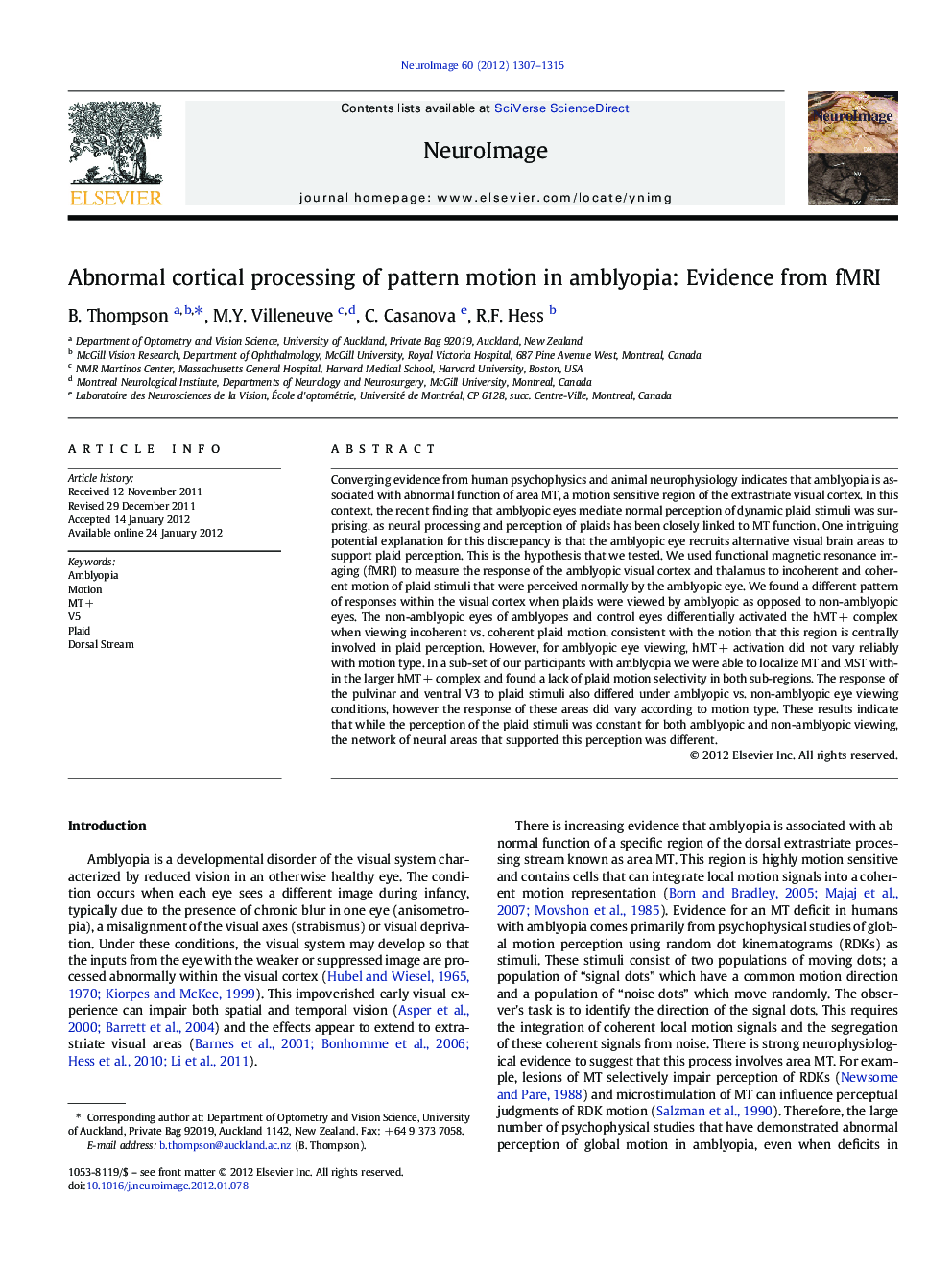 Abnormal cortical processing of pattern motion in amblyopia: Evidence from fMRI