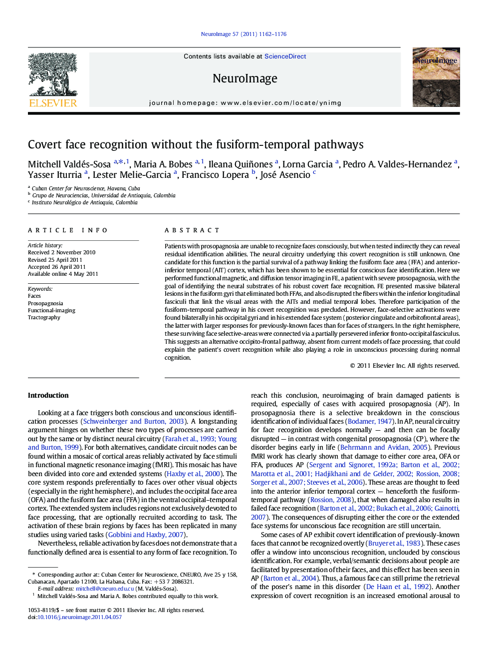 Covert face recognition without the fusiform-temporal pathways