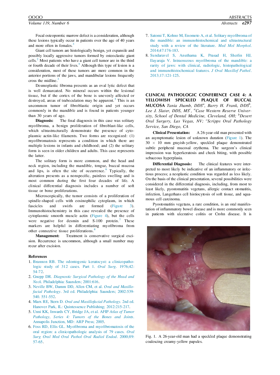 Clinical Pathologic Conference Case 4: A Yellowish Speckled Plaque of Buccal Mucosa