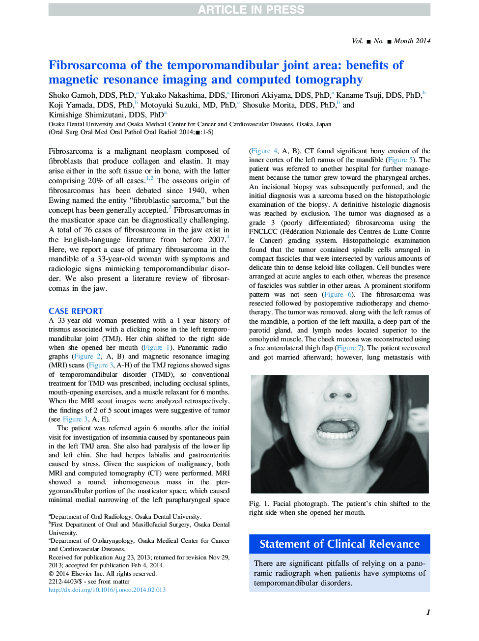 Fibrosarcoma of the temporomandibular joint area: benefits of magnetic resonance imaging and computed tomography