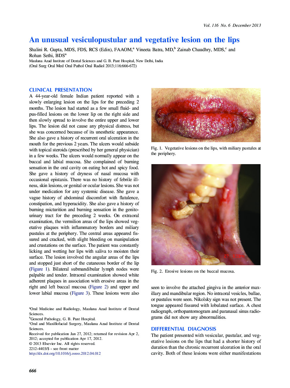 An unusual vesiculopustular and vegetative lesion on the lips