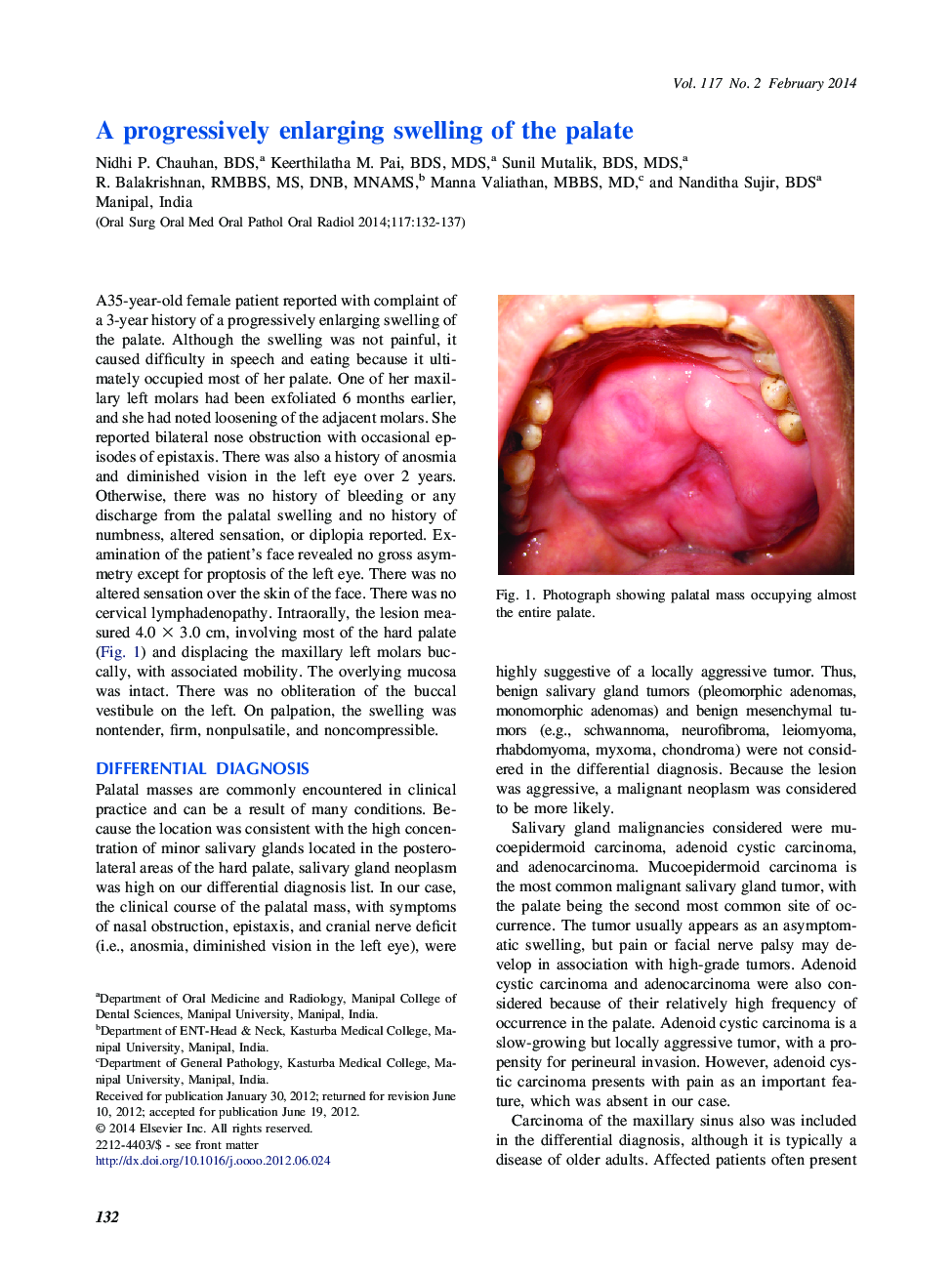 A progressively enlarging swelling of the palate