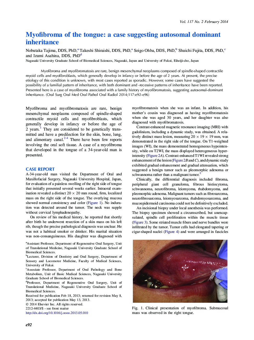 Myofibroma of the tongue: a case suggesting autosomal dominant inheritance