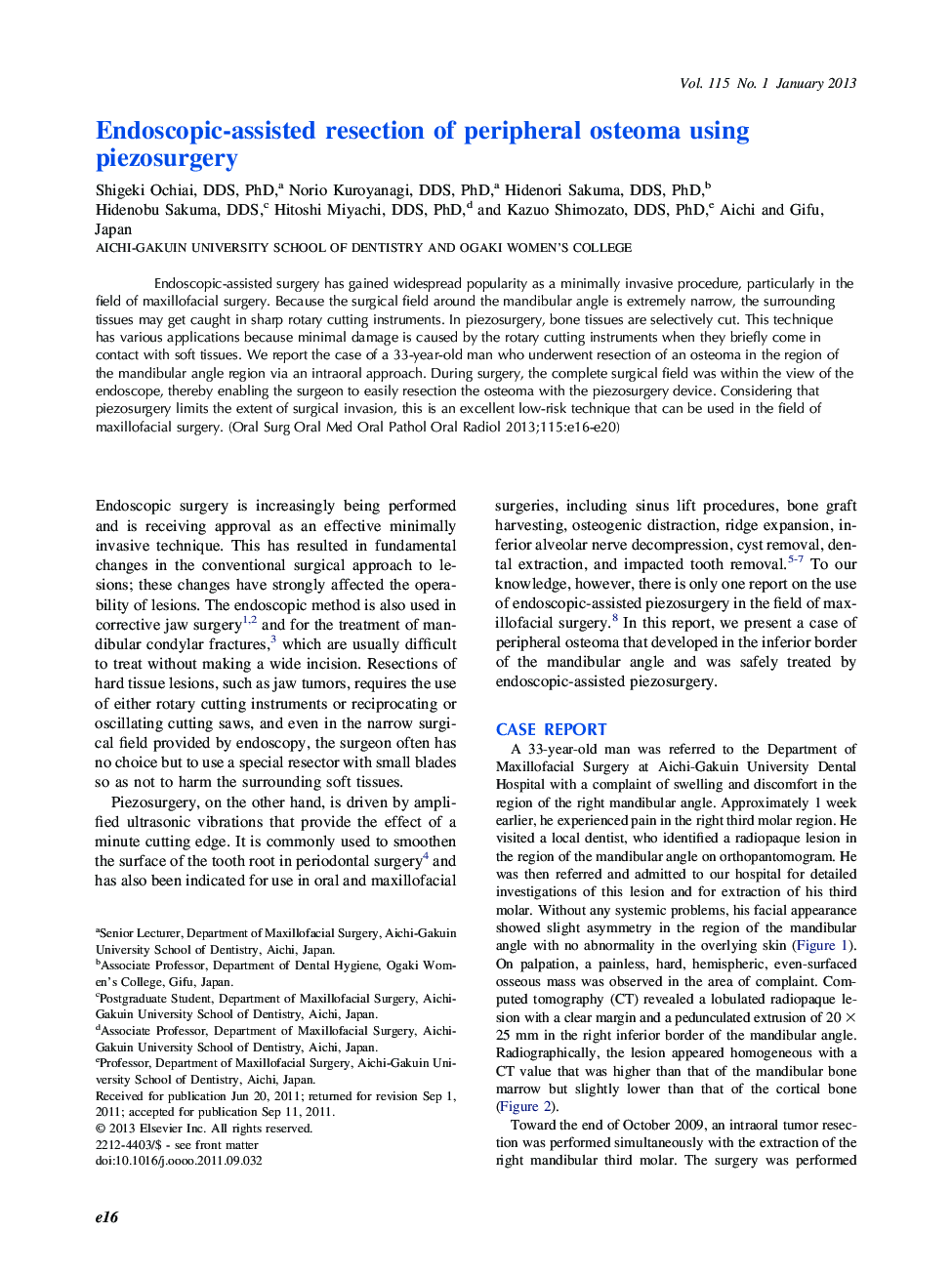 Oral and maxillofacial surgeryOnline only articleEndoscopic-assisted resection of peripheral osteoma using piezosurgery