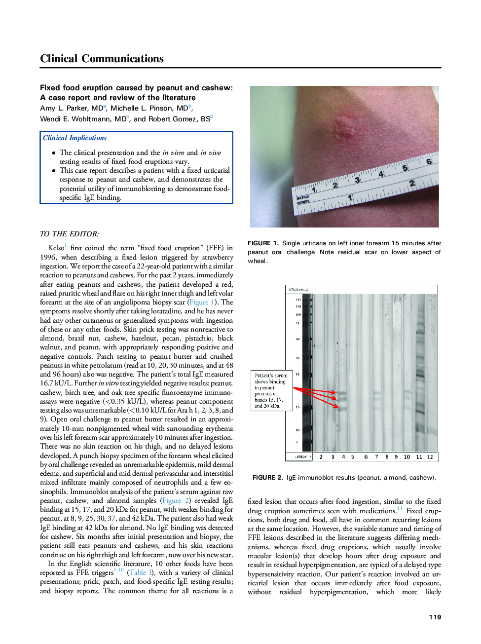 Fixed food eruption caused by peanut and cashew: A case report and review of the literature