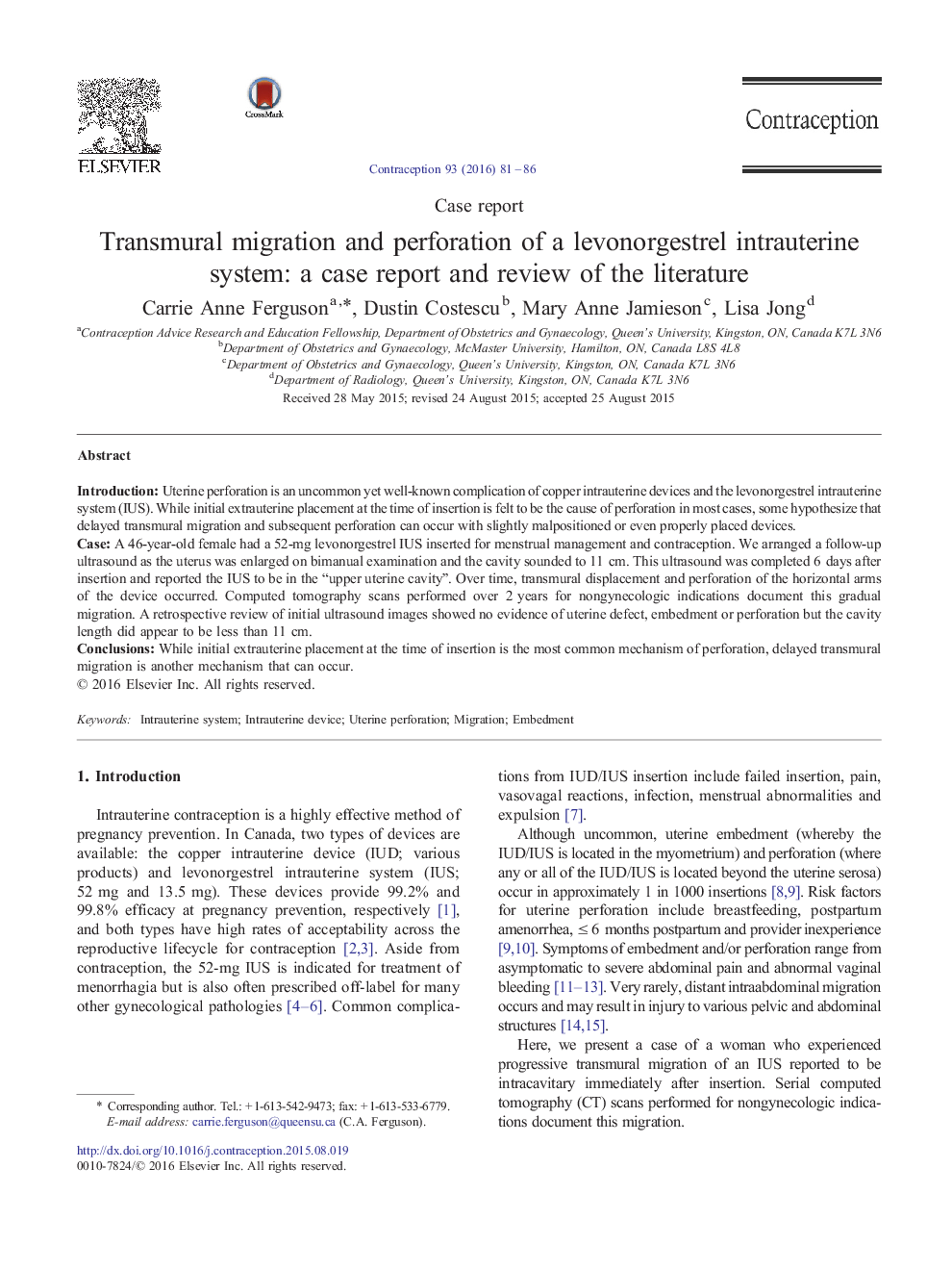 Transmural migration and perforation of a levonorgestrel intrauterine system: a case report and review of the literature