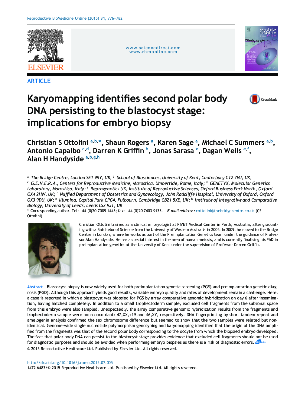Karyomapping identifies second polar body DNA persisting to the blastocyst stage: implications for embryo biopsy