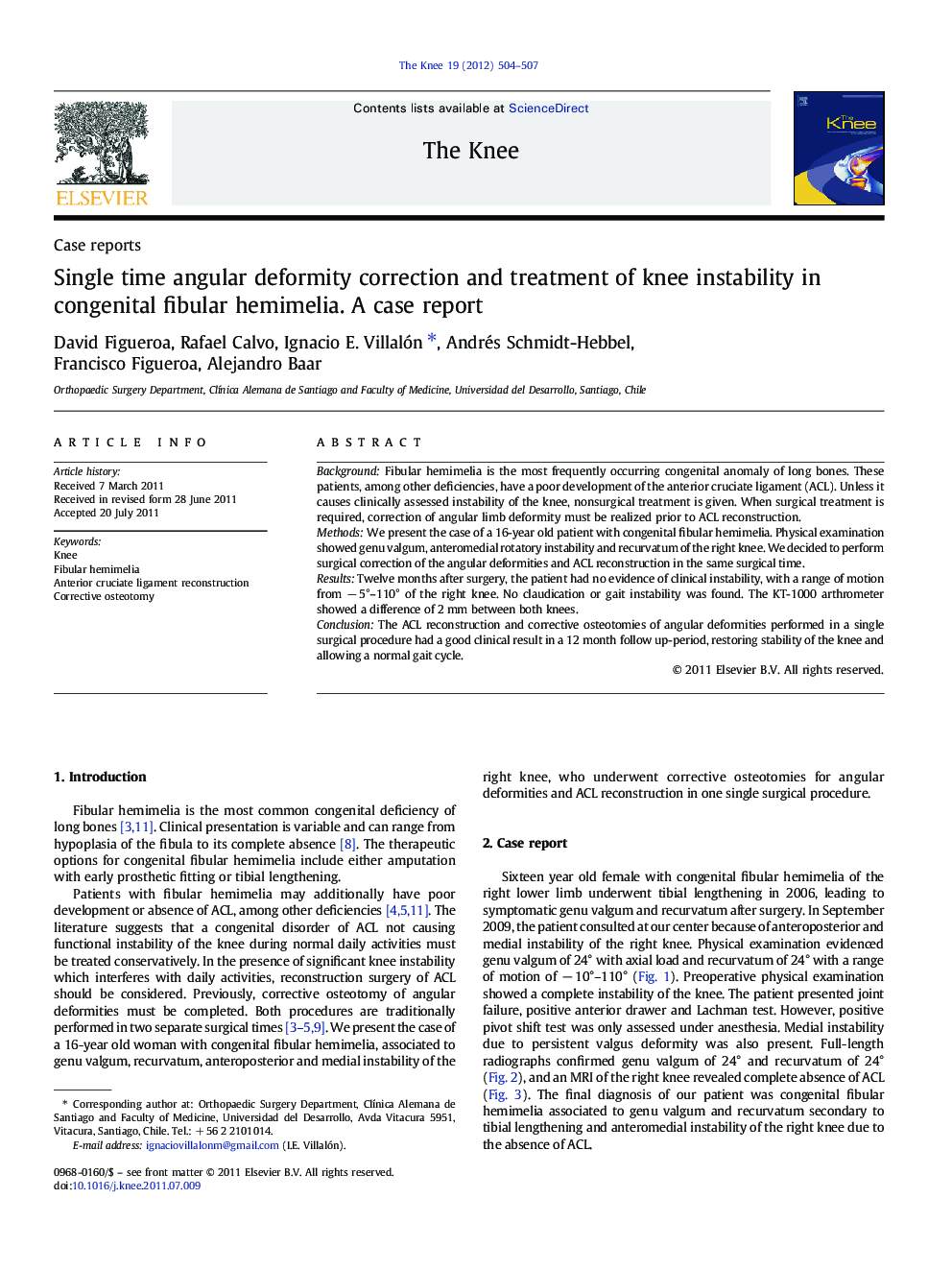 Single time angular deformity correction and treatment of knee instability in congenital fibular hemimelia. A case report