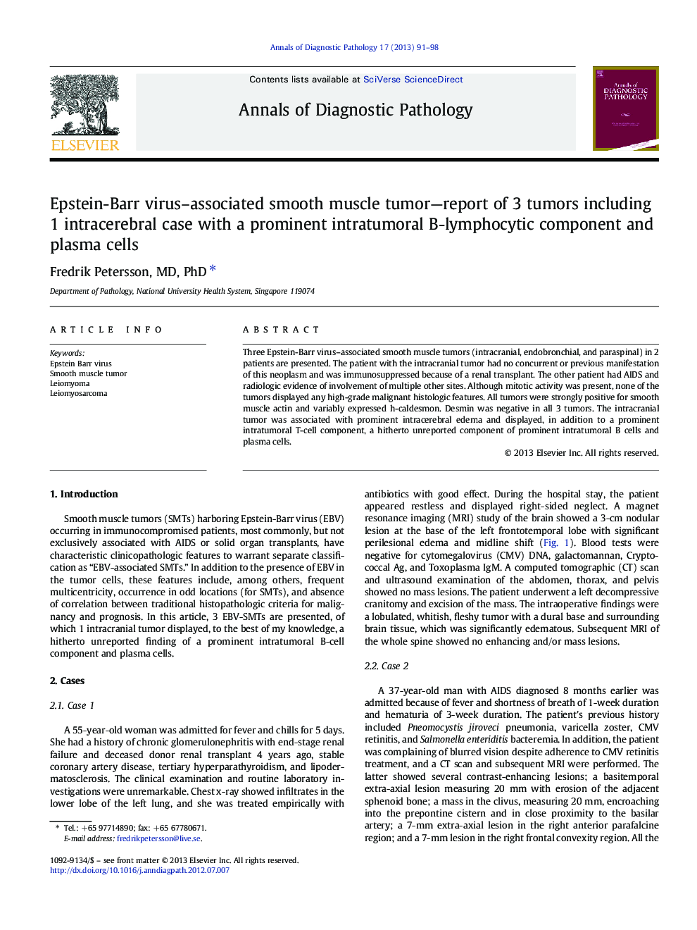 Epstein-Barr virus-associated smooth muscle tumor-report of 3 tumors including 1 intracerebral case with a prominent intratumoral B-lymphocytic component and plasma cells