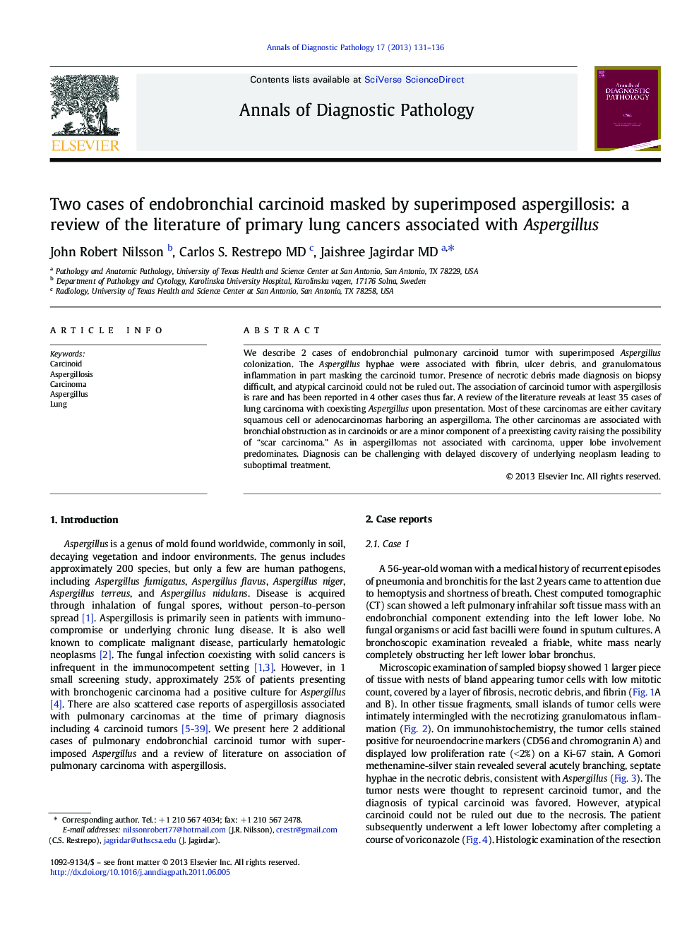 Two cases of endobronchial carcinoid masked by superimposed aspergillosis: a review of the literature of primary lung cancers associated with Aspergillus