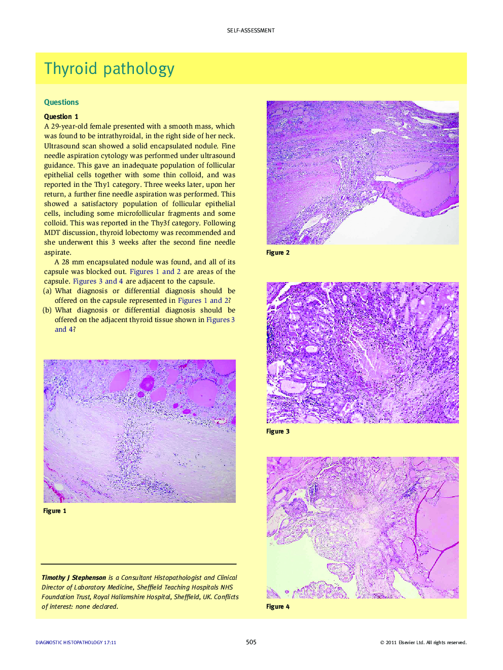 Thyroid pathology