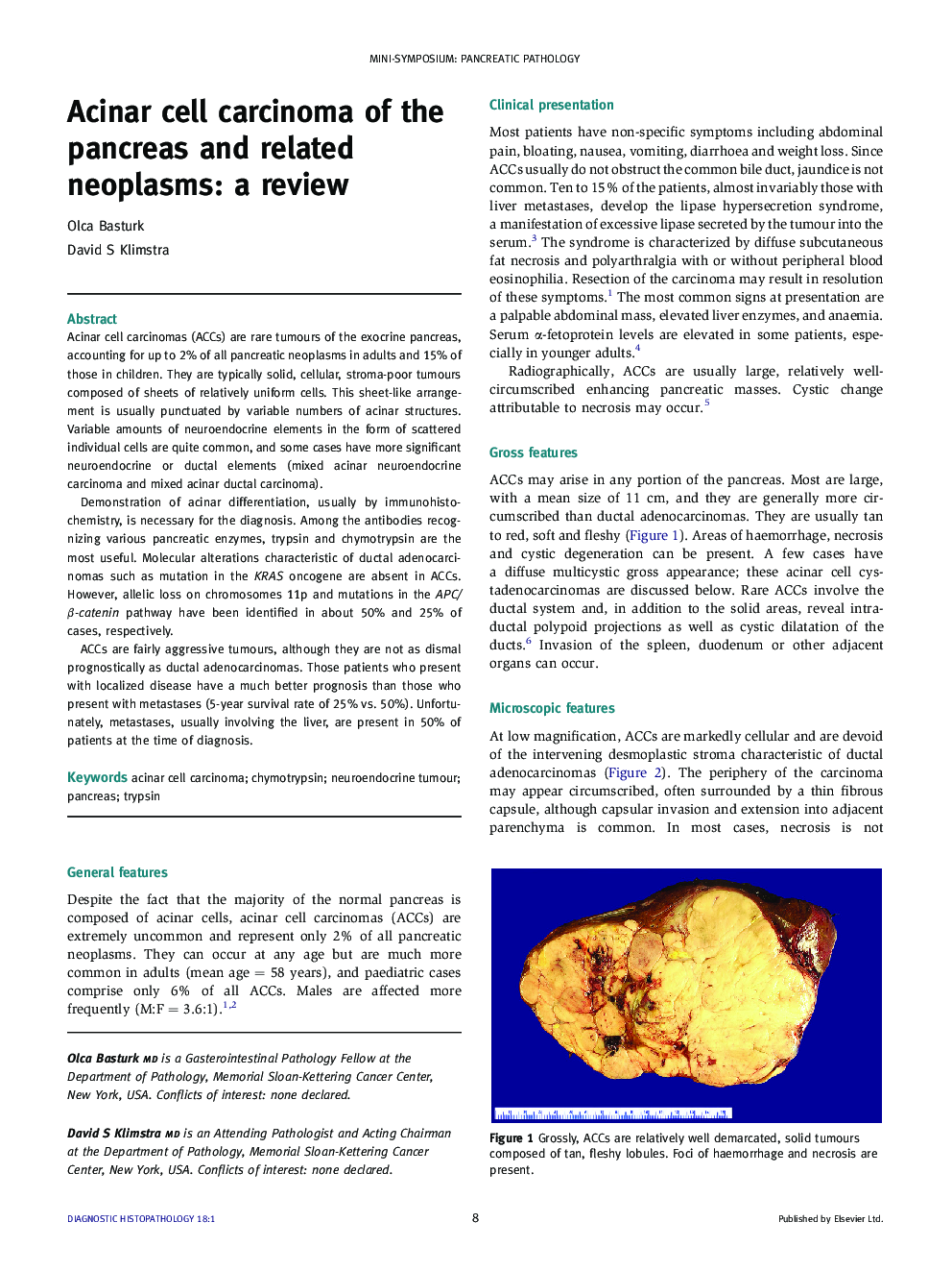 Acinar cell carcinoma of the pancreas and related neoplasms: a review