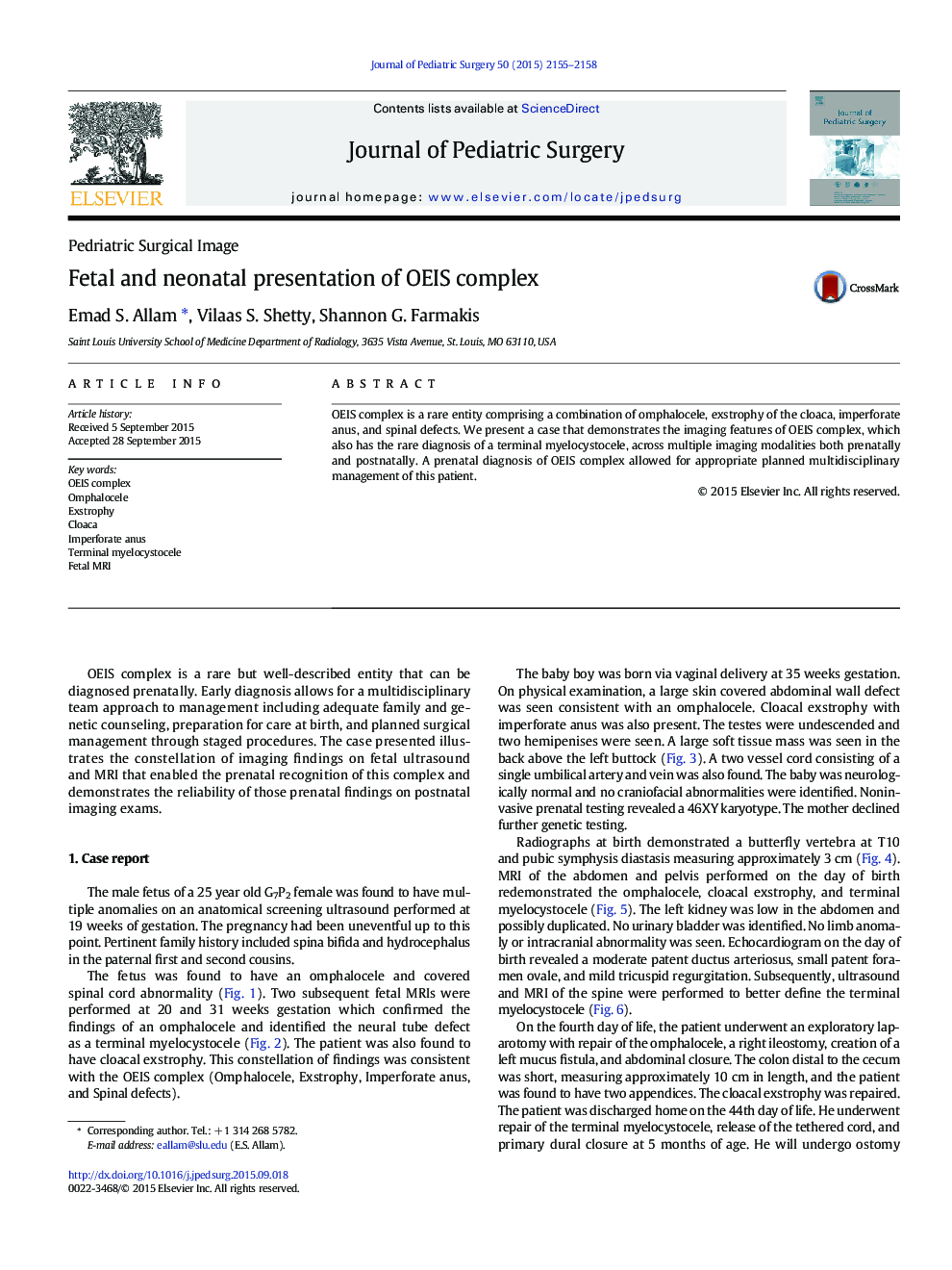 Fetal and neonatal presentation of OEIS complex