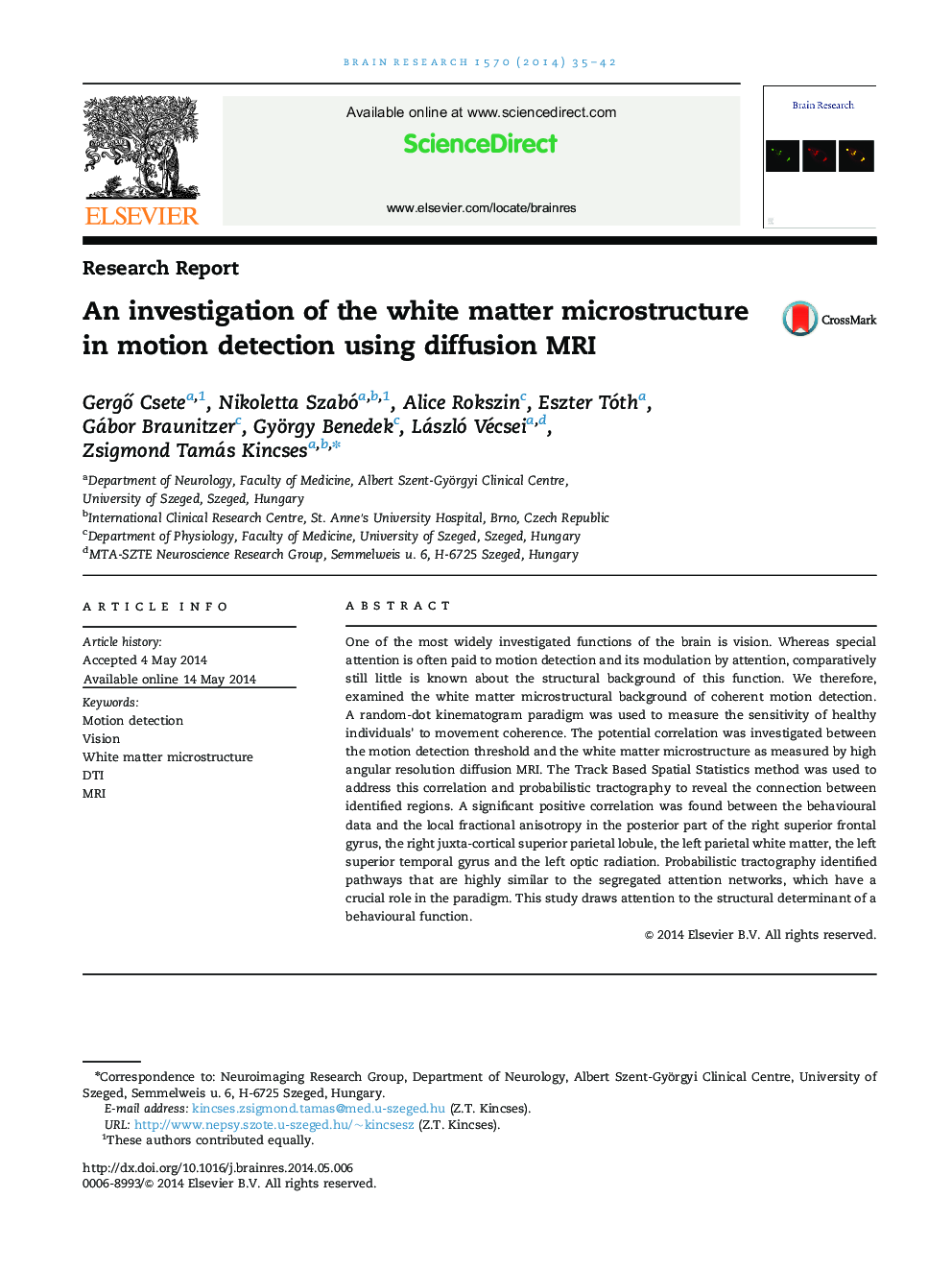 Research ReportAn investigation of the white matter microstructure in motion detection using diffusion MRI