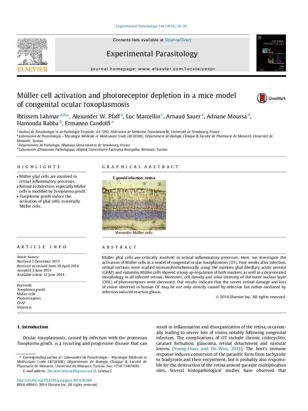 Müller cell activation and photoreceptor depletion in a mice model of congenital ocular toxoplasmosis